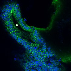 Mucin-5b Mucin-5B/DAPI