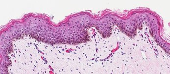 Neonatal Skin Tissue-b <b>B</b>. Neonatal Skin Tissue