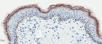 Neonatal Skin Tissue d <b>D</b>. Neonatal Skin Tissue