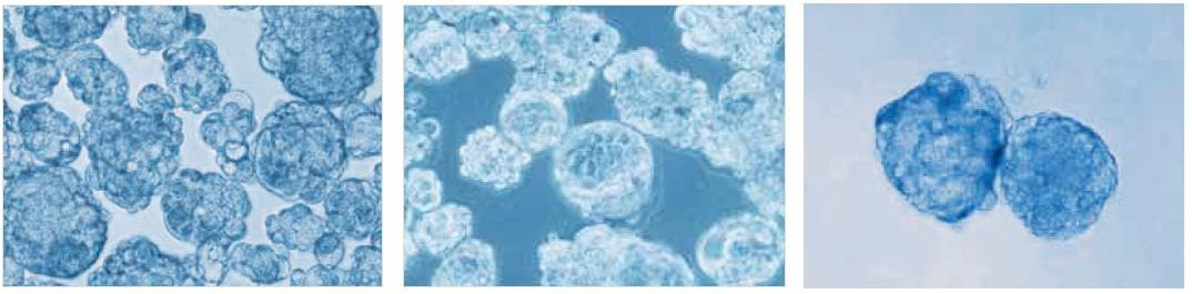 Tumor Spheroid Formation Assay Tumorsphere culture of MCF-7 breast cancer cells in the PromoCell 3D Tumorsphere Media XF after 10 passages