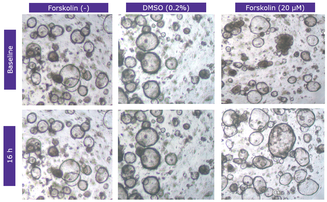 Morphology of colon organoids after forskolin-induced swelling Morphology of colon organoids after forskolin-induced swelling