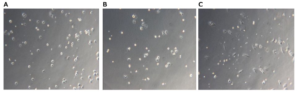 Example microscopy images of Kupffer cell culture after A) 6 hours, B) 24 hours, and C) 48 hours. Microscopy image of Kupffer cells at 6, 24, and 48 hours. Light grey square with small dark grey dots that indicate cells.