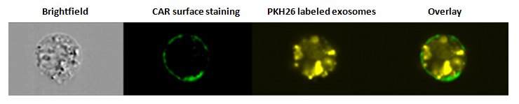 SW780 cells were stained with the surface marker CAR (Coxsackie and Adenovirus Receptor) after PKH26 labeled exosome uptake and analyzed using an Amnis® ImageStream flow cytometer. Overlay image demonstrates that exosomes have been internalized. Internalization of exosomes