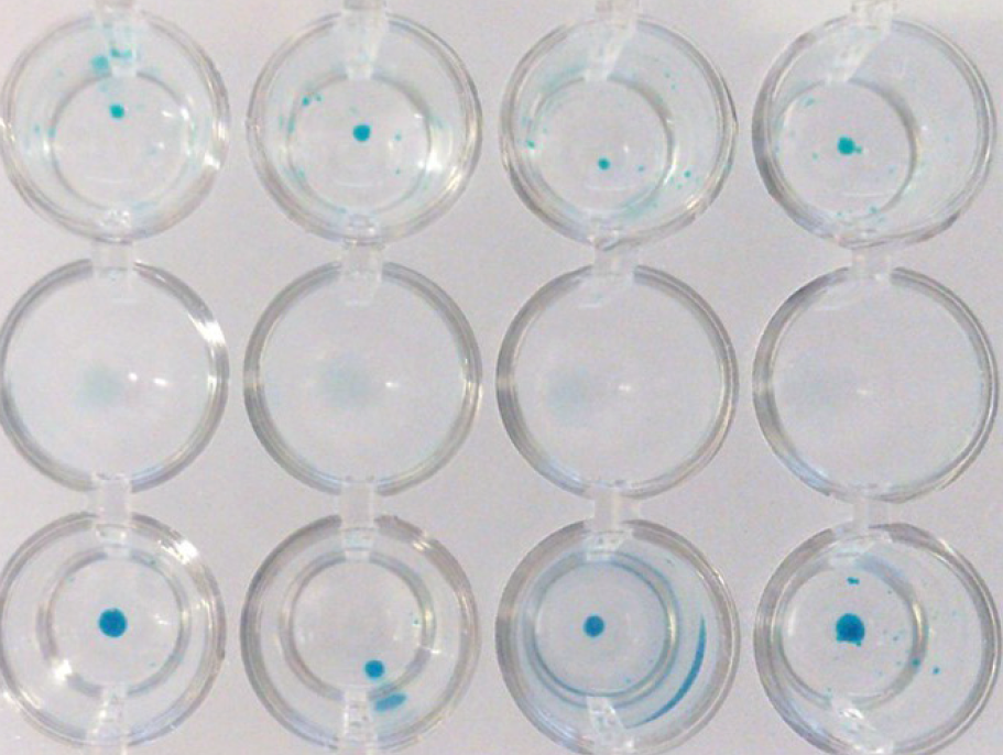 Trilineage Differentiation of Multipotent Human Mesenchymal Stem Cells (MSCs) into Osteocytes, Adipocytes and Chondrocytes Alcian Blue staining of hMSC-BM derived chondrocytes
