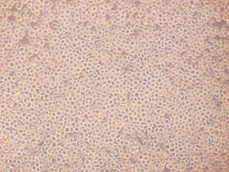 Expansion of human hematopoietic stem cells. Expansion of human hematopoietic stem cells