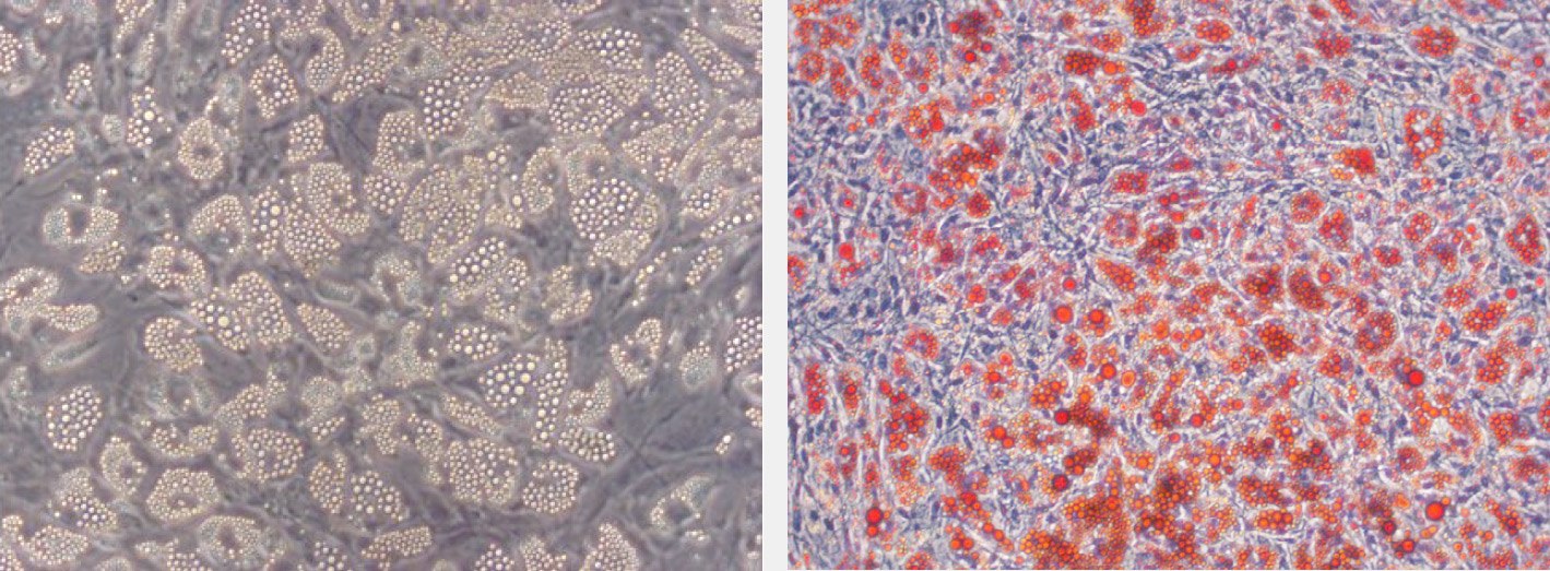 lipid-droplets Oil Red O staining of lipid droplets in hMSC-BM derived adipocytes.