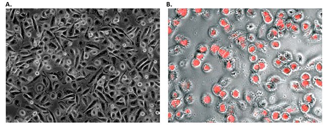 Morphology and phagocytic activity of human PBMC derived M1 macrophages Morphology and phagocytic activity of human PBMC derived M1 macrophages.