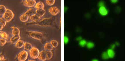 Morphology and phagocytic activity of human PBMC derived M2 macrophages Morphology and phagocytic activity of human PBMC derived M2 macrophages.