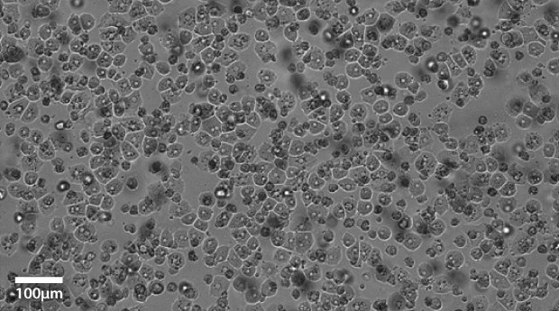 Primary hepatocytes imaged at 20x Primary hepatocytes imaged at 20x