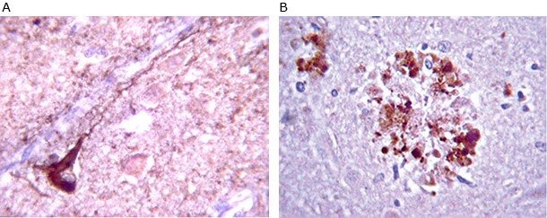 amyloid-antibody Anti-β-Amyloid antibody staining