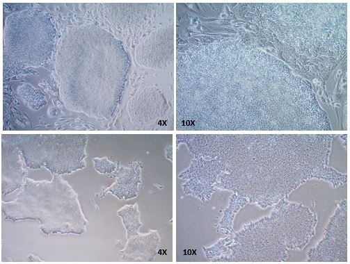 EZ-LiFT™ reagent removes feeders from human iPSC cocultures. EZ-LiFT™ reagent removes feeders from human iPSC cocultures.