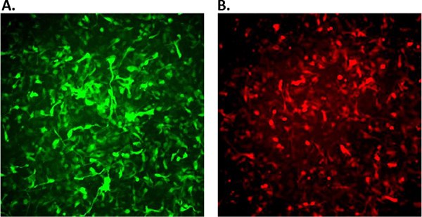fluorescence-rencell Fluorescence images of ReNcell VM infected with APPSL-GFP
