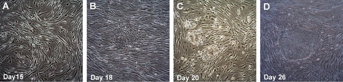 LIGHT DIAGNOSTICS Time course of human iPSC colonies generation using Human Simplicon RNA Reprogramming Kit