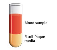 Blood sample layered onto Ficoll-Paque media Blood sample layered onto Ficoll-Paque media