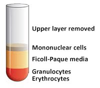 After the upper layer (Plasma) removed. After the upper layer (Plasma) removed.