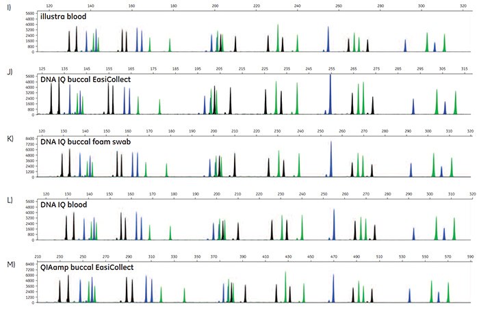 A-O. STR profiles of DNA extracted from FTA cards containing blood or buccal samples from Test Subject 1. A-O. STR profiles of DNA extracted from FTA cards containing blood or buccal samples