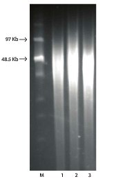PFGE of Bacterial gDNA isolated with GenElute™ Bacterial gDNA Kit. PFGE of Bacterial gDNA isolated with GenElute™ Bacterial gDNA Kit.