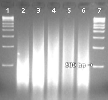Whole Genome Amplification Performed on a Soil Sample Whole Genome Amplification Performed on a Soil Sample