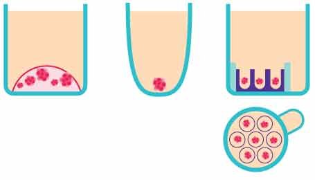 Schematic representation of the <i>in vitro</i> 3D organoid screening methods. From left to right, Matrigel<sup>®</sup>, a non-adherent surface, and Millicell<sup>®</sup> Microwell plates. : Schematic of three in vitro 3D organoid screening methods