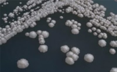 Baker's Yeast Colonies Several baker’s yeast colonies on a microbiological medium