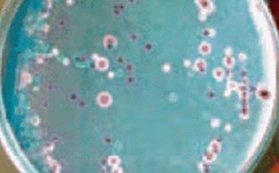 Candida Ident Agar, modified Candida Ident Agar, modified