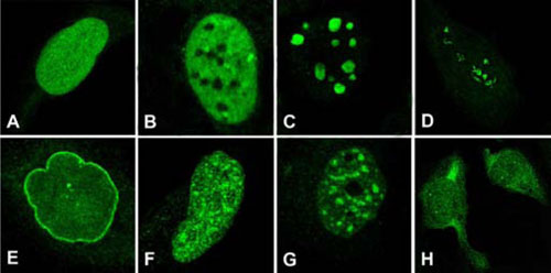 diversity-of-nuclear-staining-patterns Diversity of nuclear staining patterns