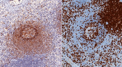 ihc-staining-spleen-cd79-cd3 Immunohistochemical staining
