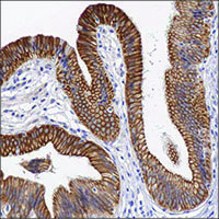 Light microscopy image of anti-PIR antibody validation by IHC on FFPE human bladder sections using diaminobenzidine (DAB) enzymatic detection (brown chromogen) and counterstaining with hematoxylin (blue). Light microscopy image of anti-PIR antibody validation by IHC on FFPE human bladder sections using diaminobenzidine (DAB) enzymatic detection (brown chromogen) and counterstaining with hematoxylin (blue).
