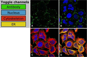 staining-of-focal-adhesions Anti-ZYX shows staining of focal adhesions
