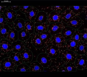 Análisis de imágenes utilizando software de imagen. Los núcleos teñidos con DAPI (azul) se detectaron automáticamente y el tamaño del citoplasma fue estimado por el usuario (contornos verdes). Las señales de PLA se muestran en rojo representando la proteína diana de interés. Las señales de PLA marcadas con círculos blancos y los núcleos delineados en amarillo se cuantificaron durante el análisis. Análisis de la imagen utilizando software de imagen