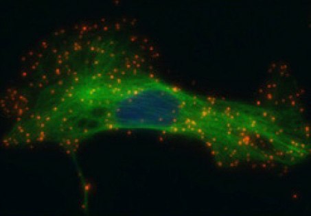 Single recognition of HER2 in SK-BR-3 cells. Red: PLA signals, each representing one HER2 protein. Green: counterstain of alpha tubulin. Blue: nucleus. PLA probes anti-Rabbit PLUS and MINUS, Duolink In Situ Detection Reagents Orange. Single recognition of HER2 in SK-BR-3 cells.