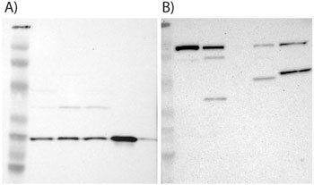 Examples of supportive WB images showing bands of predicted sizes in kDa (+/-20%) with additional bands present. Examples of supportive WB images showing bands of predicted sizes in kDa (+/-20%) with additional bands present.