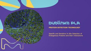 Ensayo de ligadura de proximidad (PLA) Duolink<sup>®</sup>