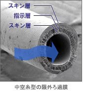 中空糸型の限外ろ過膜