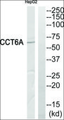 Anti-CCT6A antibody produced in rabbit affinity isolated antibody