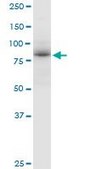 Anti-ADARB1 antibody produced in mouse purified immunoglobulin, buffered aqueous solution