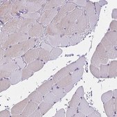 Anti-SLC12A3 antibody produced in rabbit Prestige Antibodies® Powered by Atlas Antibodies, affinity isolated antibody, buffered aqueous glycerol solution