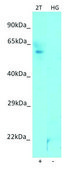 Anti-DBF4B (N-terminal) antibody produced in rabbit affinity isolated antibody