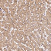 Anti-ACVR1B antibody produced in rabbit Prestige Antibodies® Powered by Atlas Antibodies, affinity isolated antibody, buffered aqueous glycerol solution