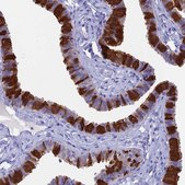 Anti-CAPS antibody produced in rabbit Prestige Antibodies® Powered by Atlas Antibodies, affinity isolated antibody, buffered aqueous glycerol solution