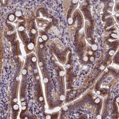 Anti-NSUN6 antibody produced in rabbit Prestige Antibodies® Powered by Atlas Antibodies, affinity isolated antibody, buffered aqueous glycerol solution