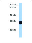 Anti-IGFBP7 antibody produced in rabbit affinity isolated antibody