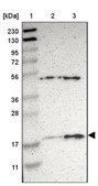 Anti-APOO antibody produced in rabbit Prestige Antibodies® Powered by Atlas Antibodies, affinity isolated antibody, buffered aqueous glycerol solution