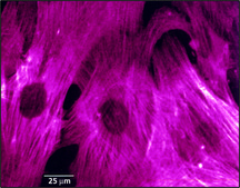 Monoclonal Anti-Actin, α-Smooth Muscle clone 1A4, ascites fluid