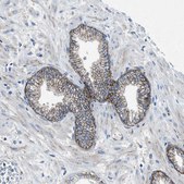 Anti-PTGFRN antibody produced in rabbit Prestige Antibodies® Powered by Atlas Antibodies, affinity isolated antibody, buffered aqueous glycerol solution