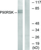 Anti-p90 RSK, C-Terminal antibody produced in rabbit affinity isolated antibody