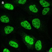 Anti-NCOA1 Antibody, clone 5B9, ZooMAb® Rabbit Monoclonal recombinant, expressed in HEK 293 cells