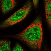 Anti-UBAP2L antibody produced in rabbit Prestige Antibodies® Powered by Atlas Antibodies, affinity isolated antibody, buffered aqueous glycerol solution