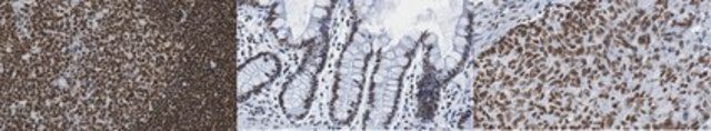 Anti-hnRNP A2B1 Antibody, clone 12B12.2 clone 12B12.2, from mouse