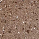 Anti-KCNJ2 antibody produced in rabbit Prestige Antibodies® Powered by Atlas Antibodies, affinity isolated antibody, buffered aqueous glycerol solution